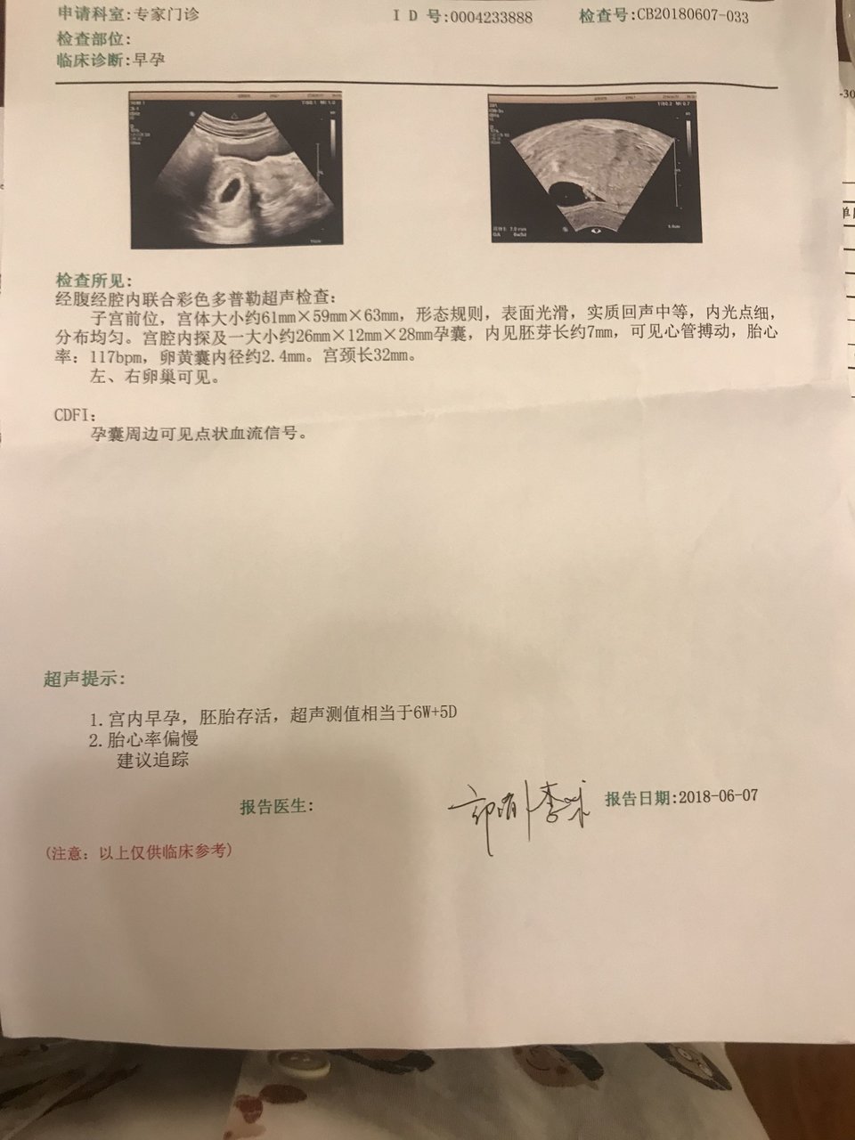 关于胎心率低