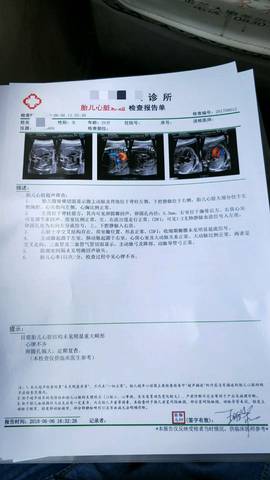 journal_insert_pic_1031787287