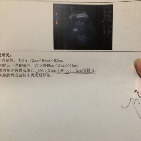 journal_insert_pic_1033312356