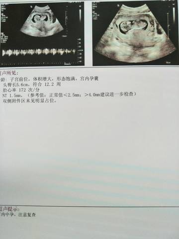 journal_insert_pic_1033818737