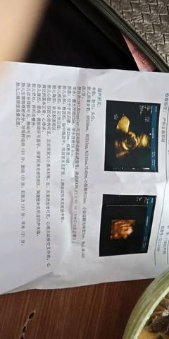 journal_insert_pic_1033732229