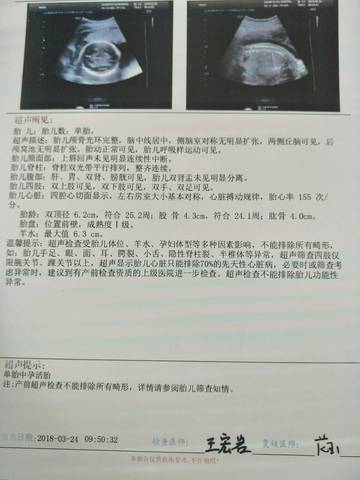 journal_insert_pic_1033818700