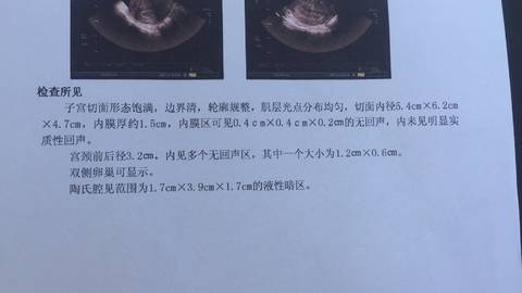 journal_insert_pic_1033872483
