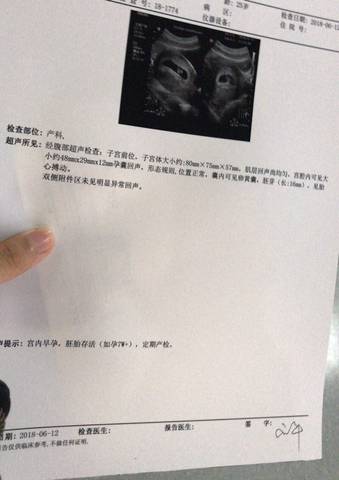 journal_insert_pic_1033778768