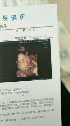 journal_insert_pic_1033871467