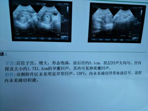 journal_insert_pic_1035379304