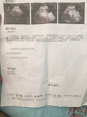 journal_insert_pic_1035280310