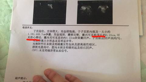 journal_insert_pic_1037207526
