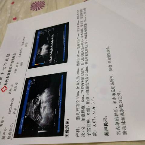 journal_insert_pic_1037749232