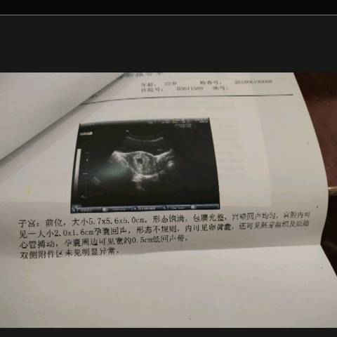 journal_insert_pic_1038660440