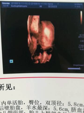 journal_insert_pic_1039856411