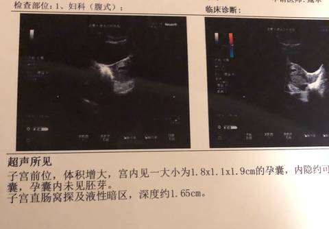 journal_insert_pic_1040476540