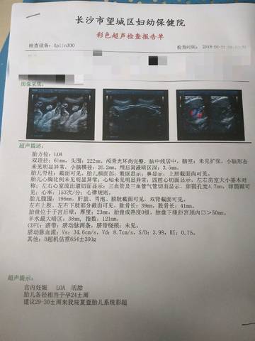 journal_insert_pic_1040851190