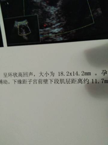 journal_insert_pic_1040691203