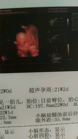 journal_insert_pic_1042248128