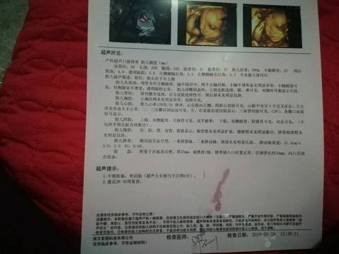 journal_insert_pic_1041944179
