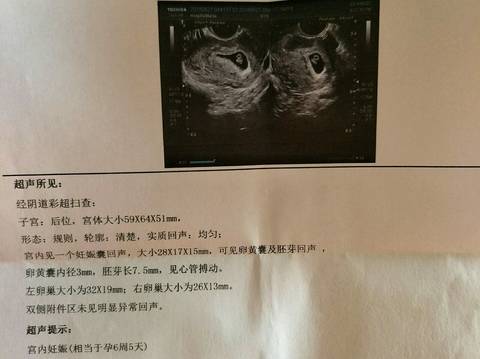 journal_insert_pic_1044063615