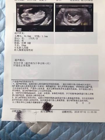 journal_insert_pic_1046700713