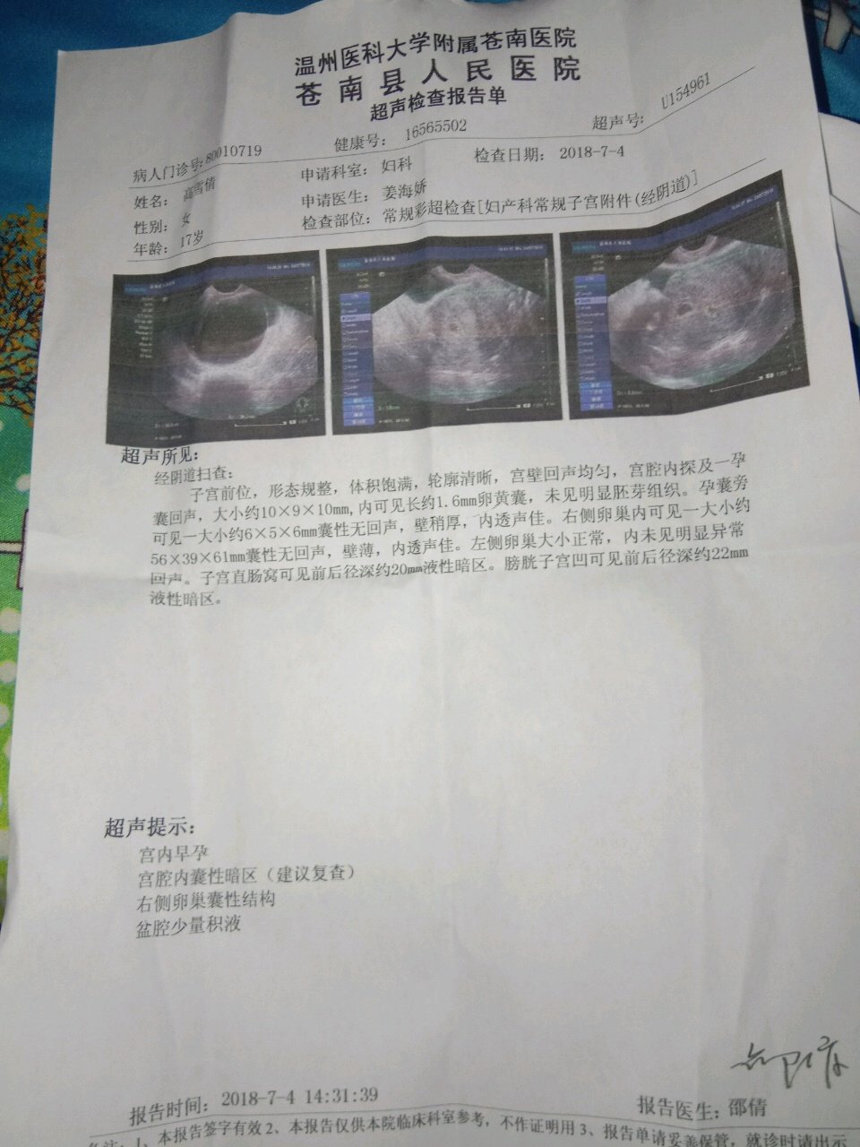 怎么办，囊肿怀孕。