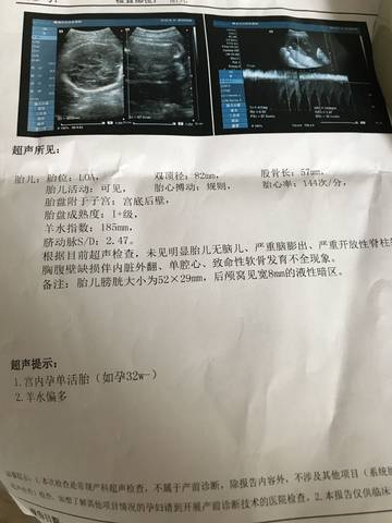 journal_insert_pic_1049074029