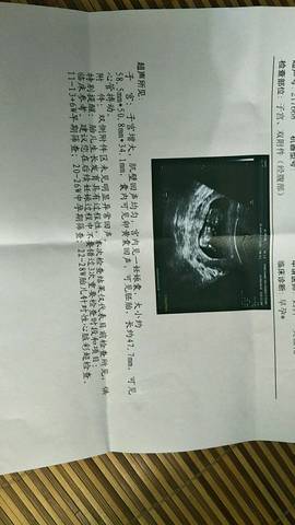 journal_insert_pic_1050967102