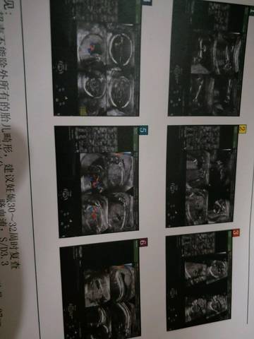 journal_insert_pic_1053962181
