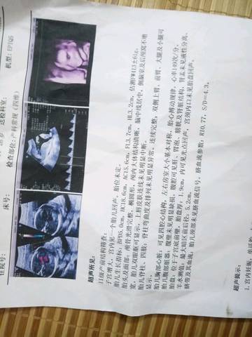 journal_insert_pic_1054510874