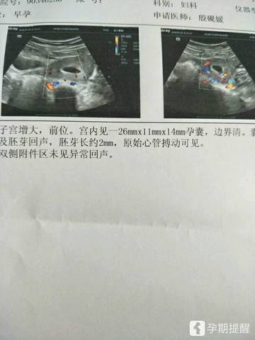 journal_insert_pic_1057382616
