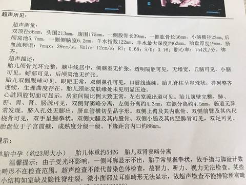 journal_insert_pic_1057389452