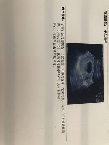 journal_insert_pic_1058578817