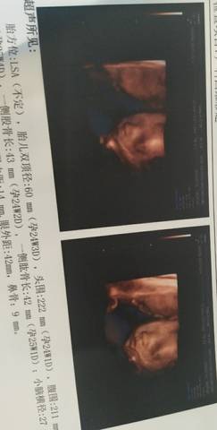 journal_insert_pic_1059388592