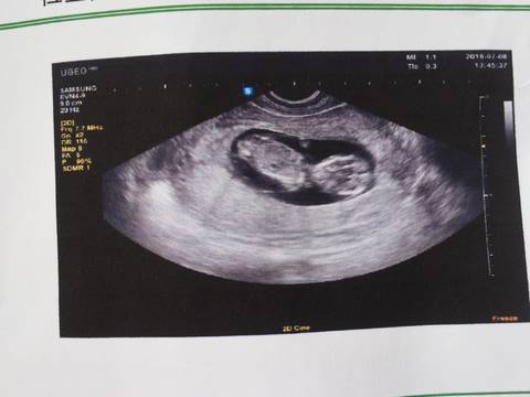 journal_insert_pic_1060835529