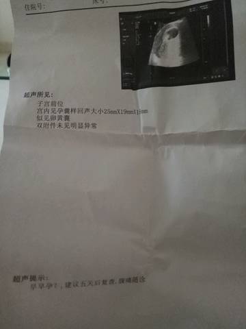 journal_insert_pic_1061355816