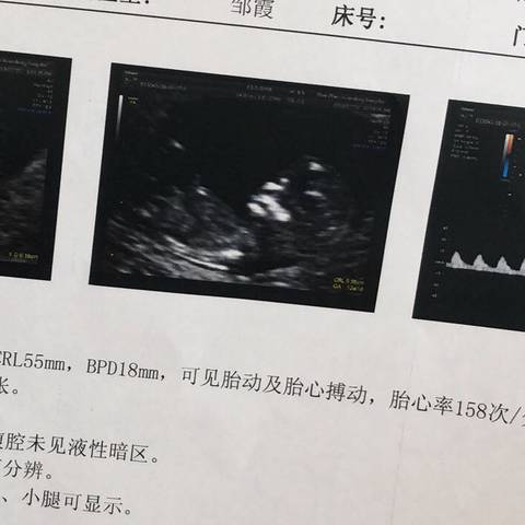 journal_insert_pic_1062625331