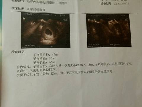 journal_insert_pic_1063124729