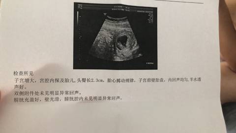 journal_insert_pic_1064235691