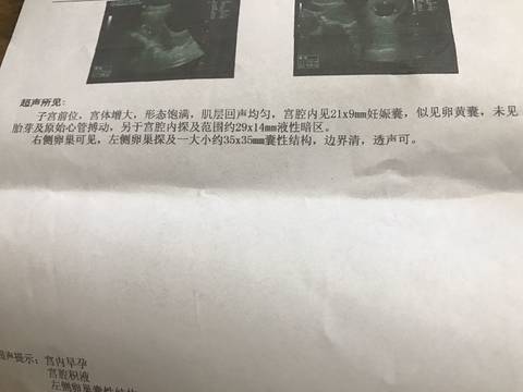journal_insert_pic_1064363688