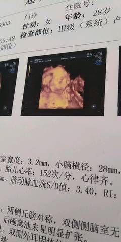 journal_insert_pic_1065188865