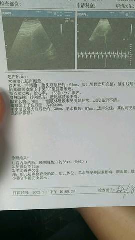 journal_insert_pic_1065602154