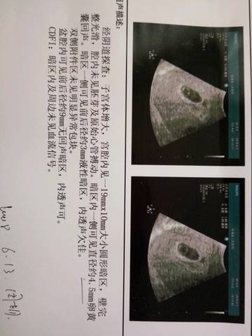journal_insert_pic_1066269464
