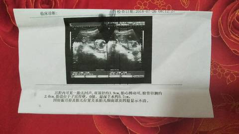 journal_insert_pic_1069357824