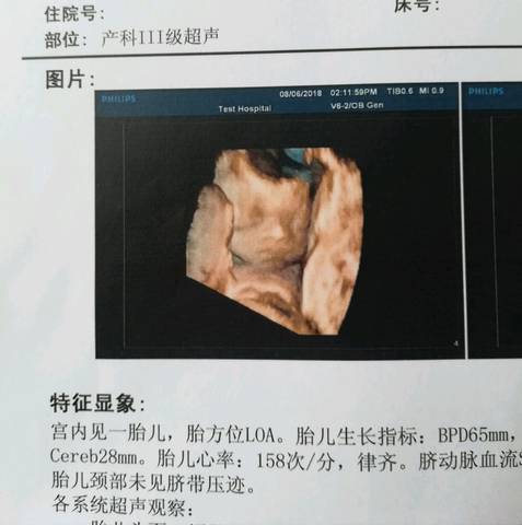 journal_insert_pic_1070144093