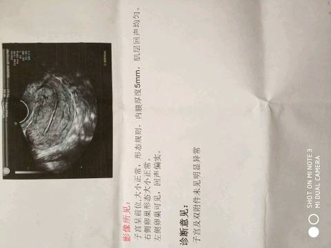 journal_insert_pic_1070040506