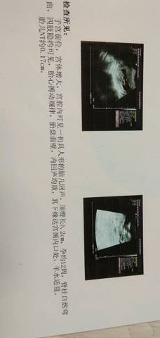 journal_insert_pic_1070297799