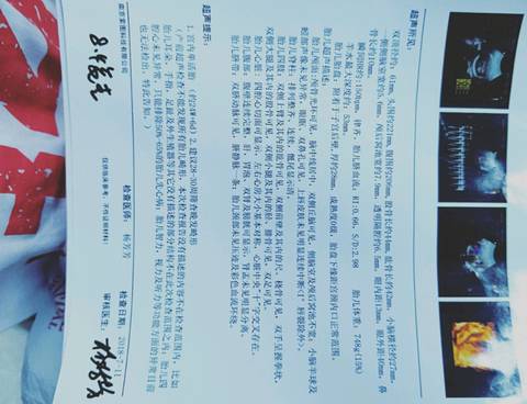 journal_insert_pic_1071009239