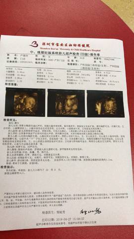 journal_insert_pic_1071383069