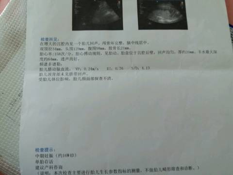 journal_insert_pic_1071880136