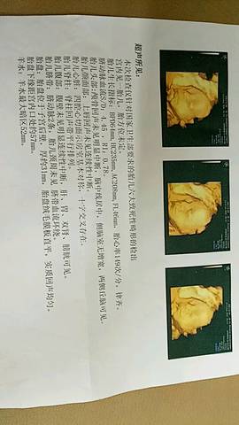 journal_insert_pic_1073793512