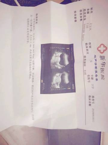 journal_insert_pic_1074005466