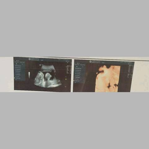 journal_insert_pic_1074649534
